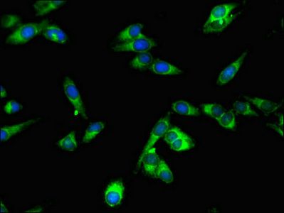 SPPL2A Antibody