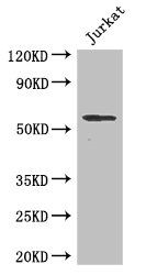 SPPL2A Antibody