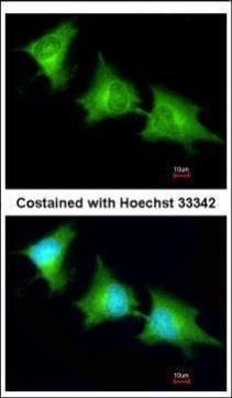 SPR Rabbit Polyclonal Antibody