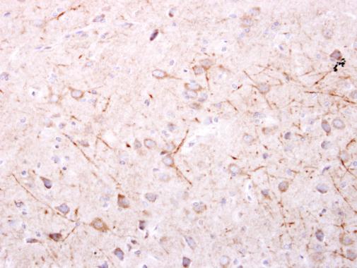 SPR Rabbit Polyclonal Antibody
