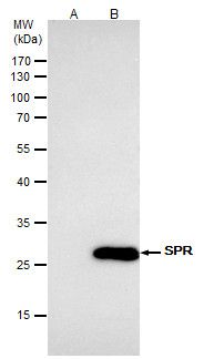 SPR Rabbit Polyclonal Antibody
