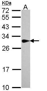 SPR Rabbit Polyclonal Antibody