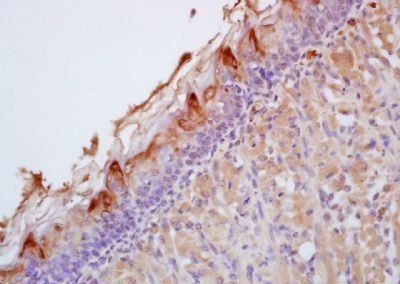 SPRR1a Rabbit Polyclonal Antibody