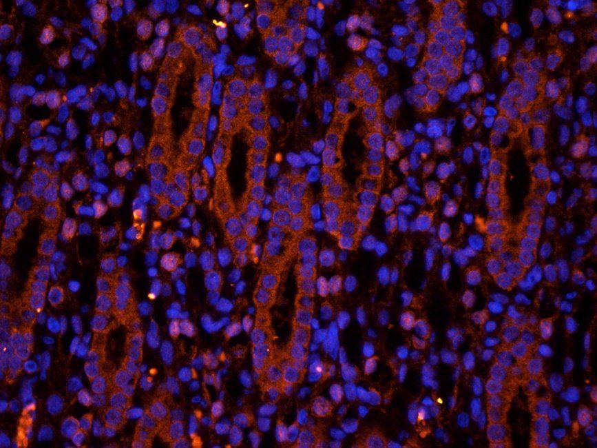 SRBP2 Rabbit Polyclonal Antibody