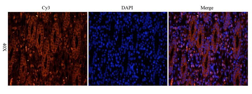 SRBP2 Rabbit Polyclonal Antibody