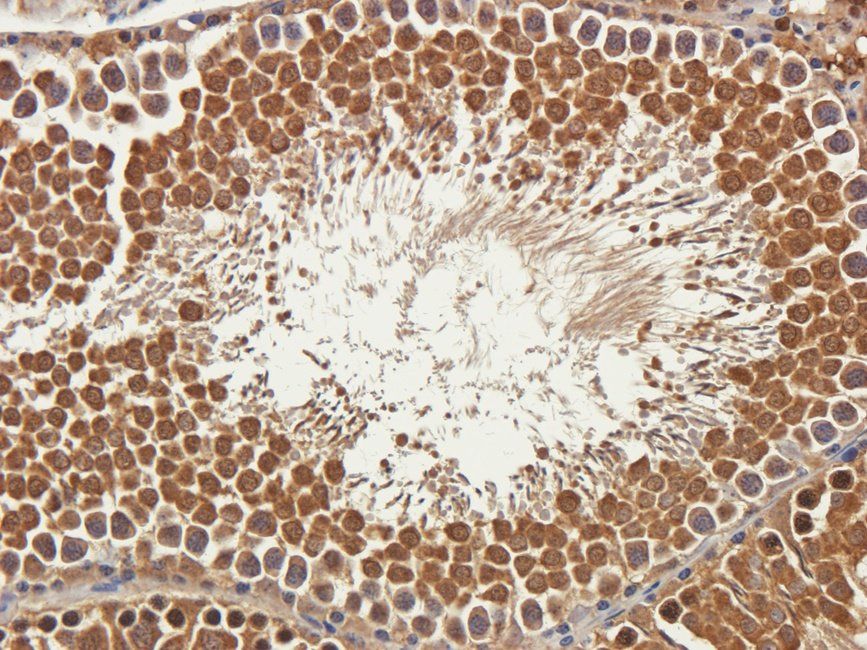 SRBP2 Rabbit Polyclonal Antibody