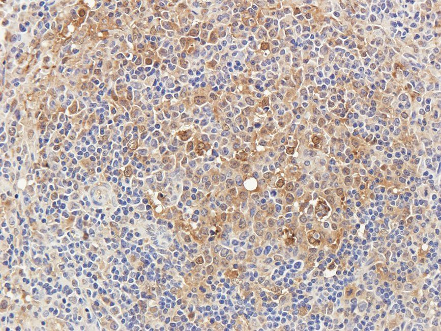 SRBP2 Rabbit Polyclonal Antibody