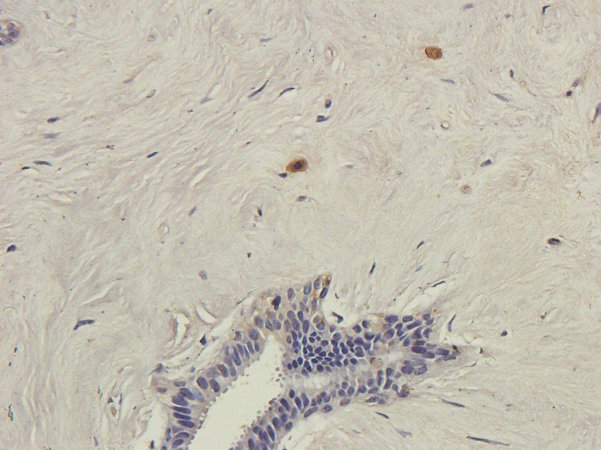 SRBP2 Rabbit Polyclonal Antibody