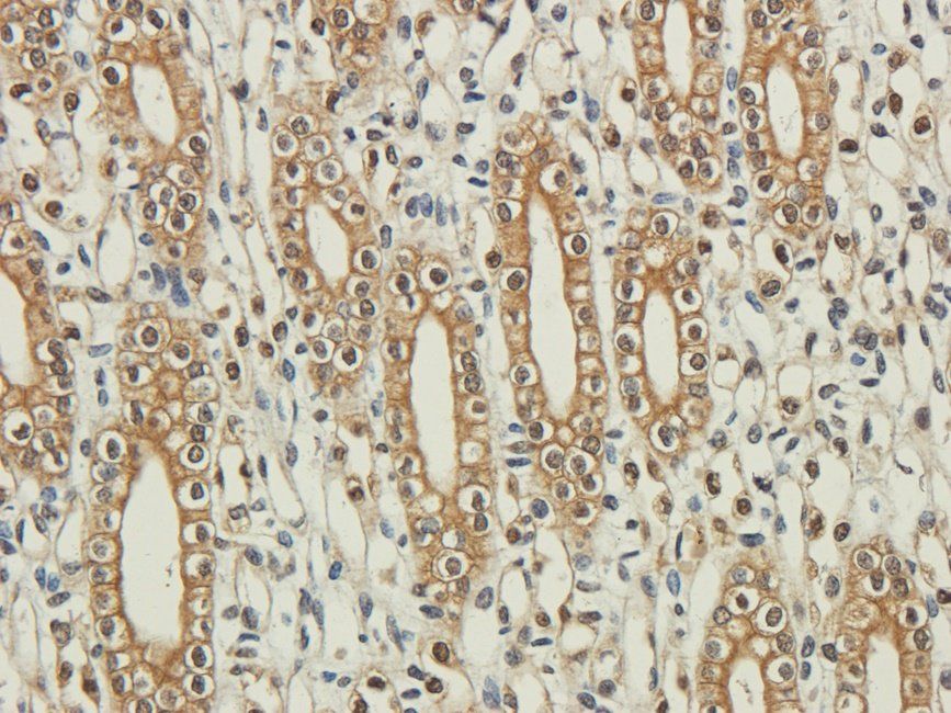 SRBP2 Rabbit Polyclonal Antibody