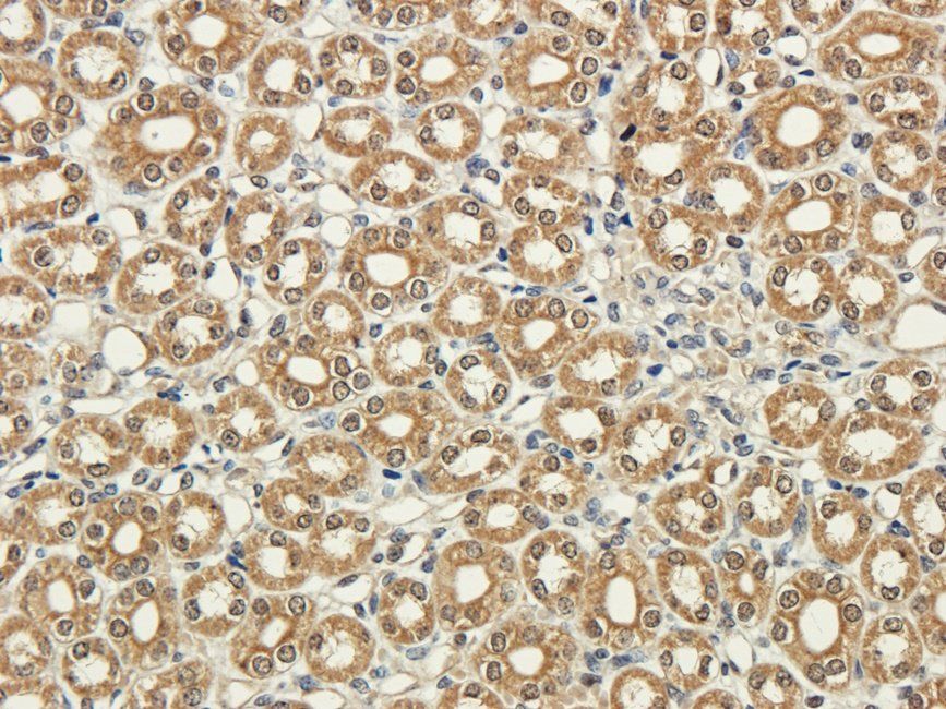 SRBP2 Rabbit Polyclonal Antibody