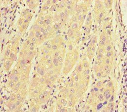SRRM2 Antibody