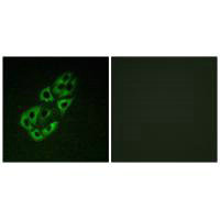 SSBP1 Antibody