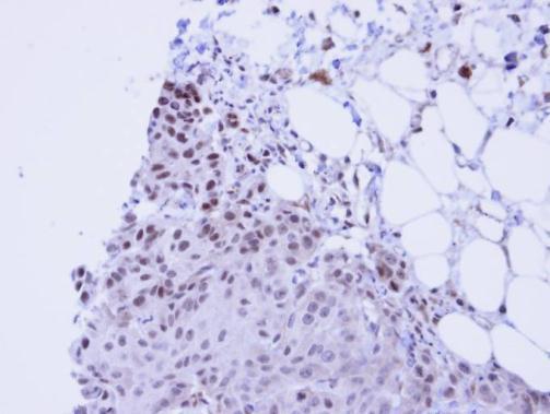 SSRP1 Rabbit Polyclonal Antibody