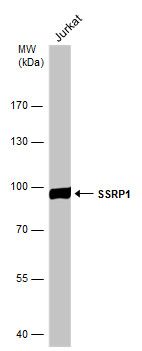 SSRP1 Rabbit Polyclonal Antibody
