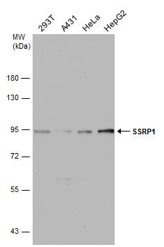 SSRP1 Rabbit Polyclonal Antibody