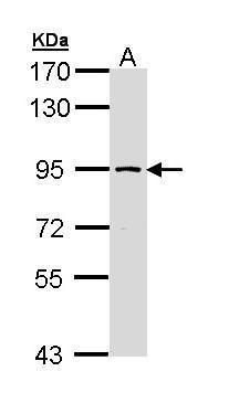 SSRP1 Rabbit Polyclonal Antibody