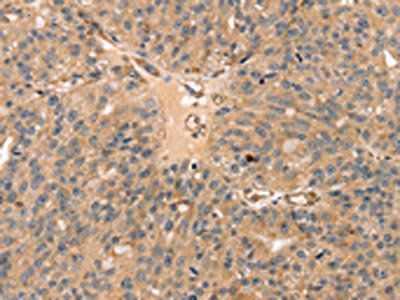 SSX2IP Antibody