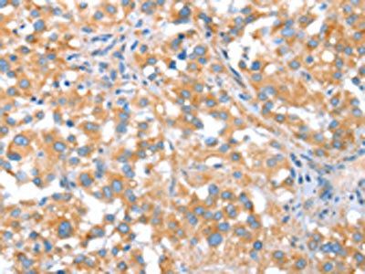ST14 Antibody