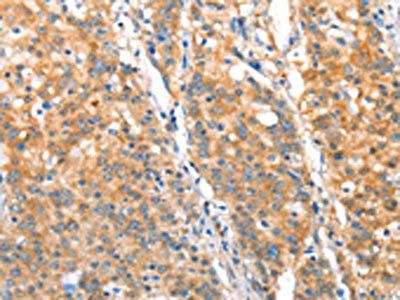 ST14 Antibody