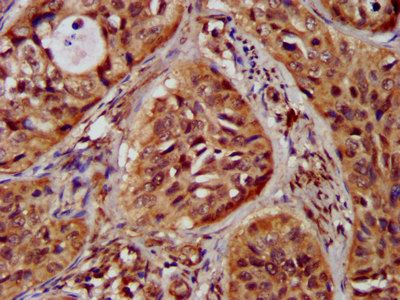 ST3GAL4 Antibody