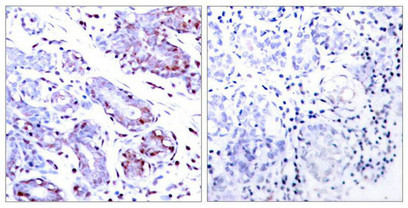 STAT1 Antibody