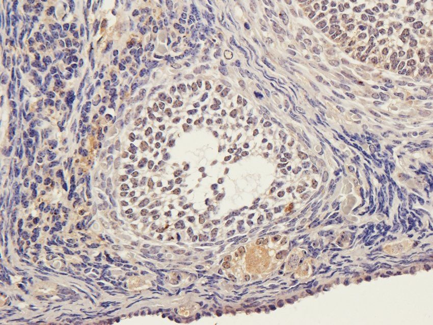 STAT5B Rabbit Polyclonal Antibody