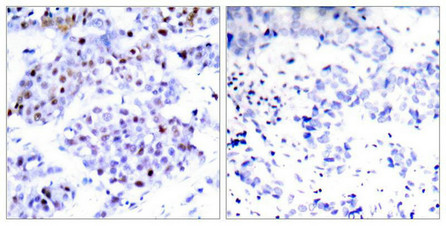 STAT6 Antibody