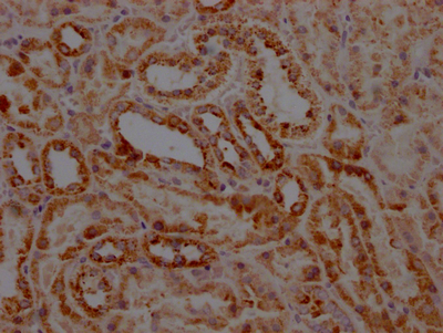 STAT6 Antibody