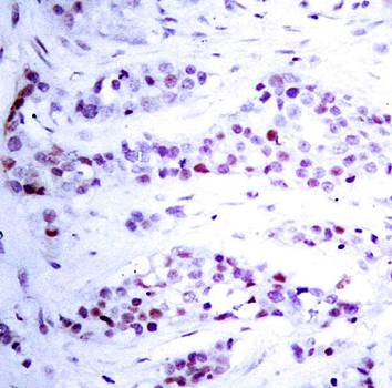 STAT6 (Ab-641) Antibody