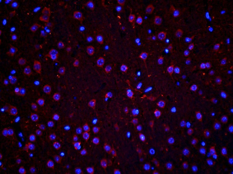 Stathmin Rabbit Polyclonal Antibody