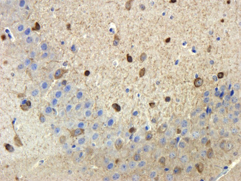 Stathmin Rabbit Polyclonal Antibody