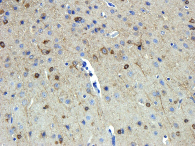 Stathmin Rabbit Polyclonal Antibody