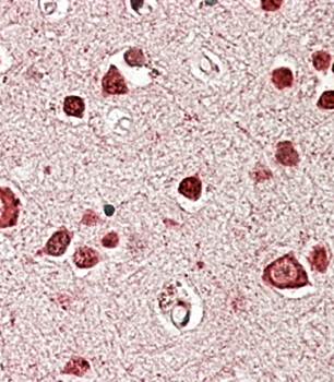 STK39/SPAK Antibody