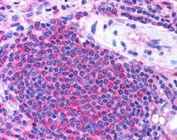 STS2/TULA (internal) Antibody