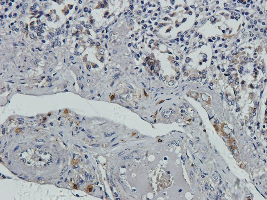 Substance P Rabbit Polyclonal Antibody