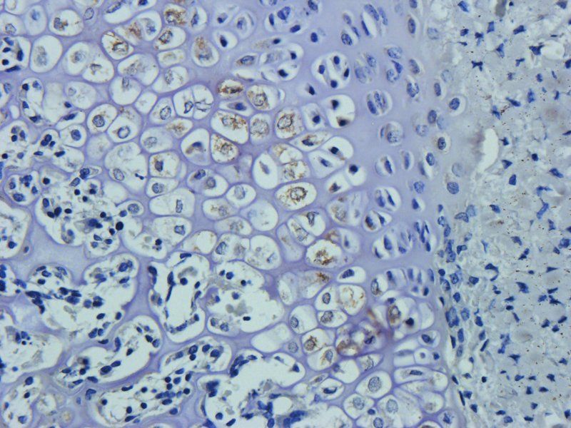 Substance P Rabbit Polyclonal Antibody