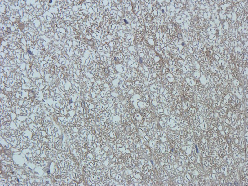Substance P Rabbit Polyclonal Antibody