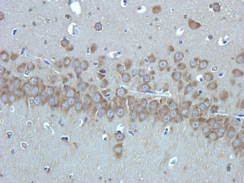 Substance P Rabbit Polyclonal Antibody