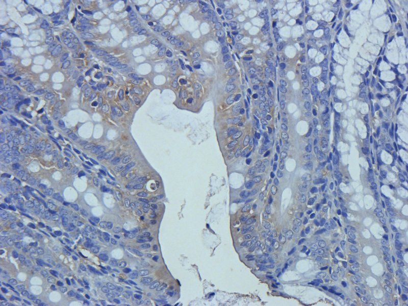 Substance P Rabbit Polyclonal Antibody