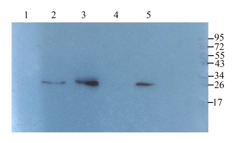 Substance P Rabbit Polyclonal Antibody