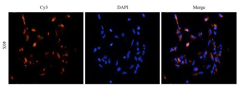 Substance P Rabbit Polyclonal Antibody