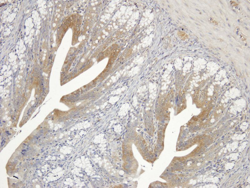 Substance P Rabbit Polyclonal Antibody