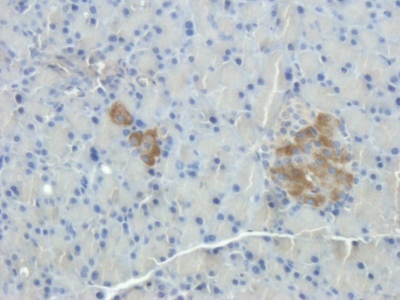 Substance P Rabbit Polyclonal Antibody