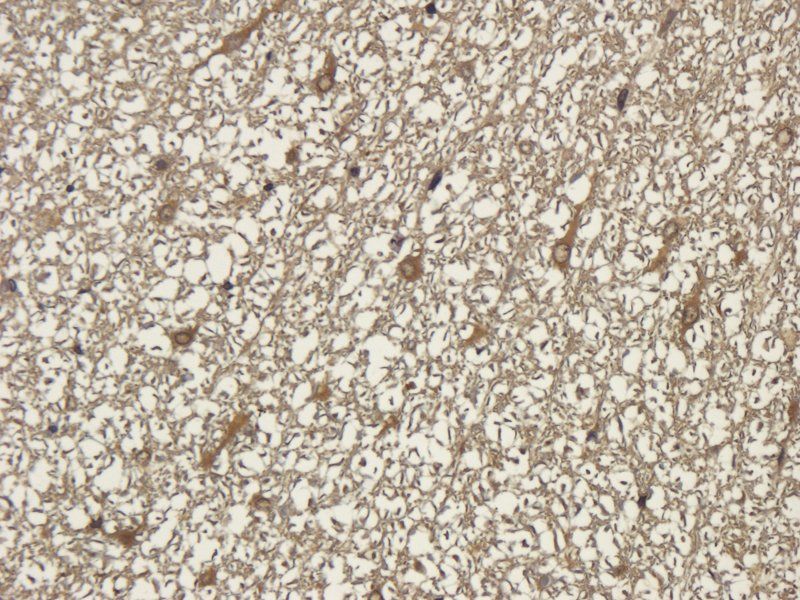 Substance P Rabbit Polyclonal Antibody