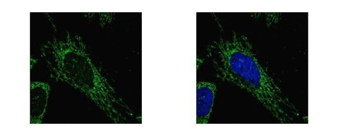 SUCLG1 Rabbit Polyclonal Antibody