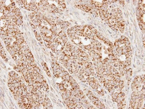 SUCLG1 Rabbit Polyclonal Antibody