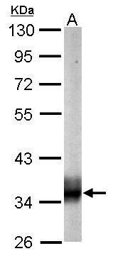SUCLG1 Rabbit Polyclonal Antibody