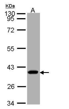 SUCLG1 Rabbit Polyclonal Antibody