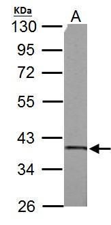 SUCLG1 Rabbit Polyclonal Antibody