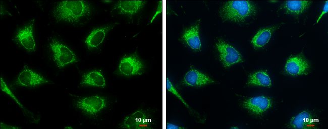SUCLG2 Rabbit Polyclonal Antibody